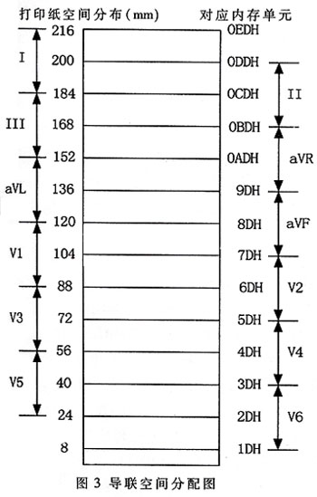 為各個導聯(lián)分配的熱敏打印紙空間與緩沖內存單元