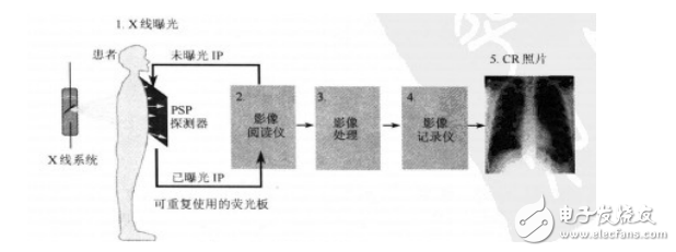 CR成像系統(tǒng)的構造與成像原理分析
